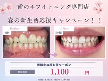 ホワイトニングショップ 徳島藍住店
