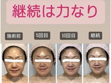 マリア(MARIA)/ここまで変われて維持できる◎