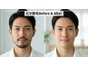 【男性髭脱毛】メンズ清涼感アップ
