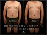 <全員>【5周年記念メニュー】脂肪冷却6CUP¥35,000
