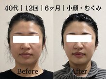 マルウル(maluulu)の雰囲気(慢性的なむくみやくすみが改善、一回り小さい卵型小顔に)