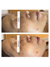 ヨリ(yori)/マーメイドセル　6回