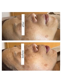 ヨリ(yori)/マーメイドセル　6回