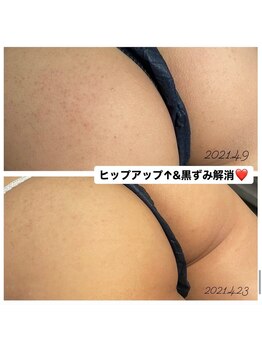 マーズ(Mars)/ホワイトハーブピーリング