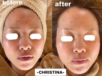 リノアンド(Lino&)/水分爆上げ水光肌へ