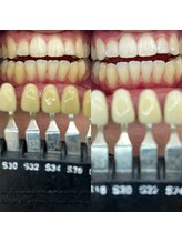 トウキョウスワーズ 池袋店(TOKYO SWRS)/#ホワイトニング #池袋 #渋谷