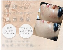 ユミサロン(U Mi Salon)