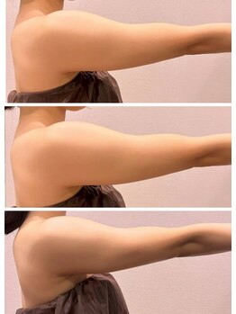 ビュウナ 銀座(BEAUNA)/マルチウェーブリフト