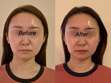 薬手名家 心斎橋店/お客様ビフォーアフター