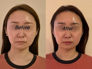 薬手名家 心斎橋店/お客様ビフォーアフター