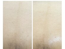 アットユウ(@yu)/フェムエステ