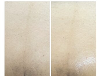 アットユウ(@yu)/フェムエステ