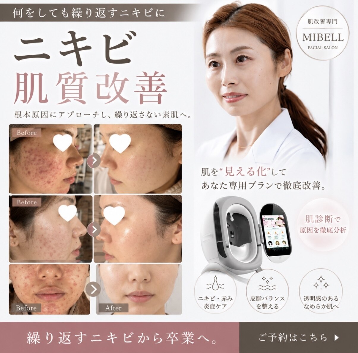 高崎市でダイヤモンドピーリングが人気のエステサロン｜ホットペッパー