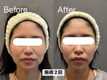 ヘレフア(Hele Hua)