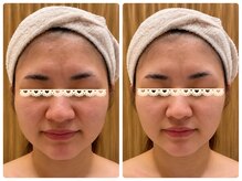 エピファニー(Epi phany Total Beauty Salon)