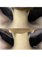 サロン ミツワ(Salon Mitsuwa)/脱毛