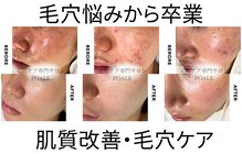 ポアレ 熊谷店(POALE)
