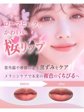 リフレ21(Refre21)/黒ずみケアで桜リップに