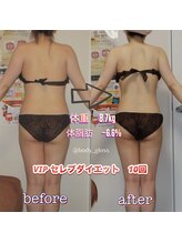 ボディグロス 梅田店(BODY GLOSS)/VIPセレブ10回ー8.7kg