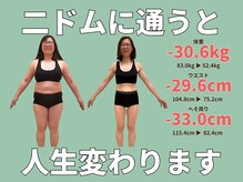 ニドム