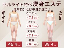 ラ パルレ 富山店の雰囲気（ブライダルエステ/フェイシャル/ボディケア/ドレス映え/花嫁）