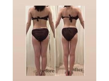 ポルトボーテ(Porte Beaute)の写真