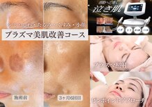 グラチア(Gratiae)