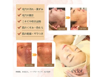 エクレ(eclat)の写真