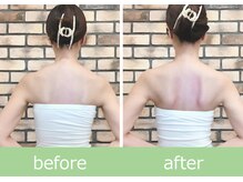 ひびきレディース整体 日吉/肩甲骨美人！羽が生える花嫁整体