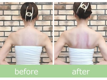 ひびきレディース整体 日吉/肩甲骨美人!羽が生える花嫁整体
