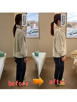 あべ整骨院 整体院/巻き肩改善