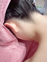 ミヤビ 竹ノ塚店(MIYA美)/うなじ脱毛♪