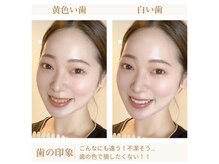 NAホワイトニング 自由が丘店の雰囲気（白く輝く歯は第一印象に大きく影響＊数回で理想の白い歯に♪）