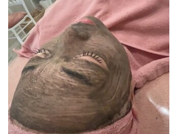 ディンプル(Dimple)/ハーブピーリング