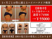 サンティエール