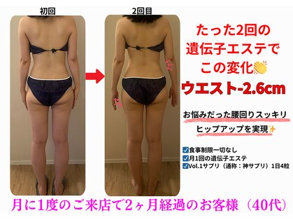 エーシーサロン 六本木店(acsalon)の写真