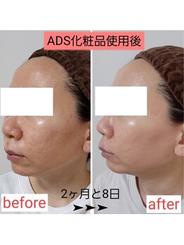 ミュー(Mieux)/こんなに変わってるなんて！