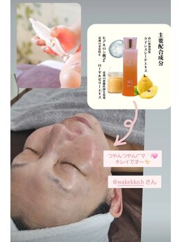 ステラ(Stella)/つや肌フエイシャルコース3500円