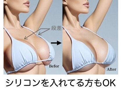 ブレスト 新宿本店(Breast)の写真