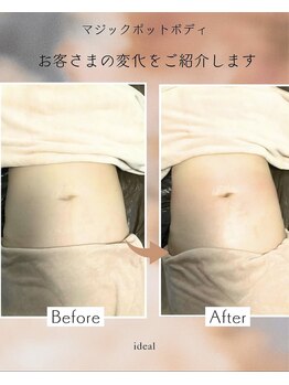 イデアル 箱崎(ideal)の写真/クビレ、下腹が気になる方へ
