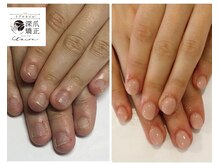 トイロ(toiro)/自爪「質」と「土台」を変えます