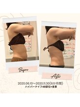 プレミアムボディケア 清水桜橋店(Premium Body Care)/お客様ビフォーアフター(上半身)