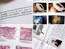 フェレザ 新潟(Felleza)/厚労省認定国産脱毛機