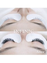 アンフィニック 外苑前店(INFINIC)/ノンアレルゲンLED施術