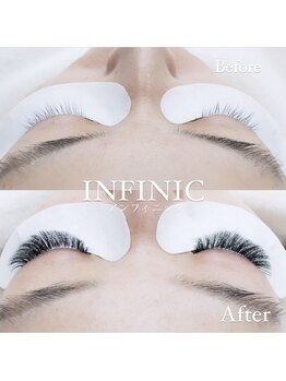 アンフィニック 外苑前店(INFINIC)/ノンアレルゲンLED施術