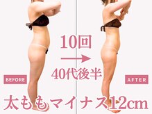 べモーレ 上本町 谷町九丁目(Bemolle)の雰囲気（結婚式を控える花嫁様の痩身エステも多く担当させて頂いてます☆）