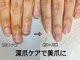 レヴィア(Revia)の写真/パラジェル×深爪×巻き爪ケアできるサロン【見せたくなる指先に◆深爪ケア（ケア用品付）13,500円】