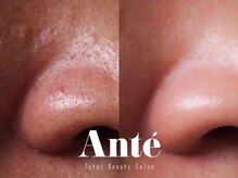 アンテサロン 関内店(Antesalon)