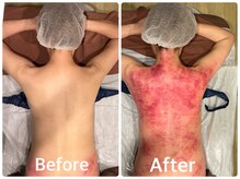 グラン ソレイユ(GRAN SOLEIL)