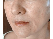 ミルフォイル(Milfoil)/維持力のあるタルミケアB